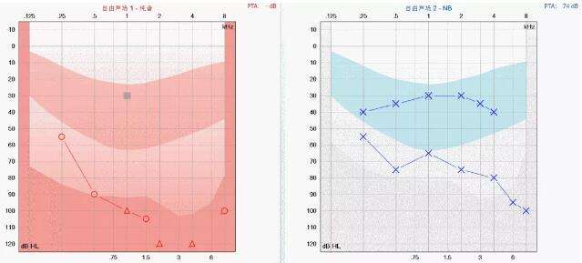 �ൺ������