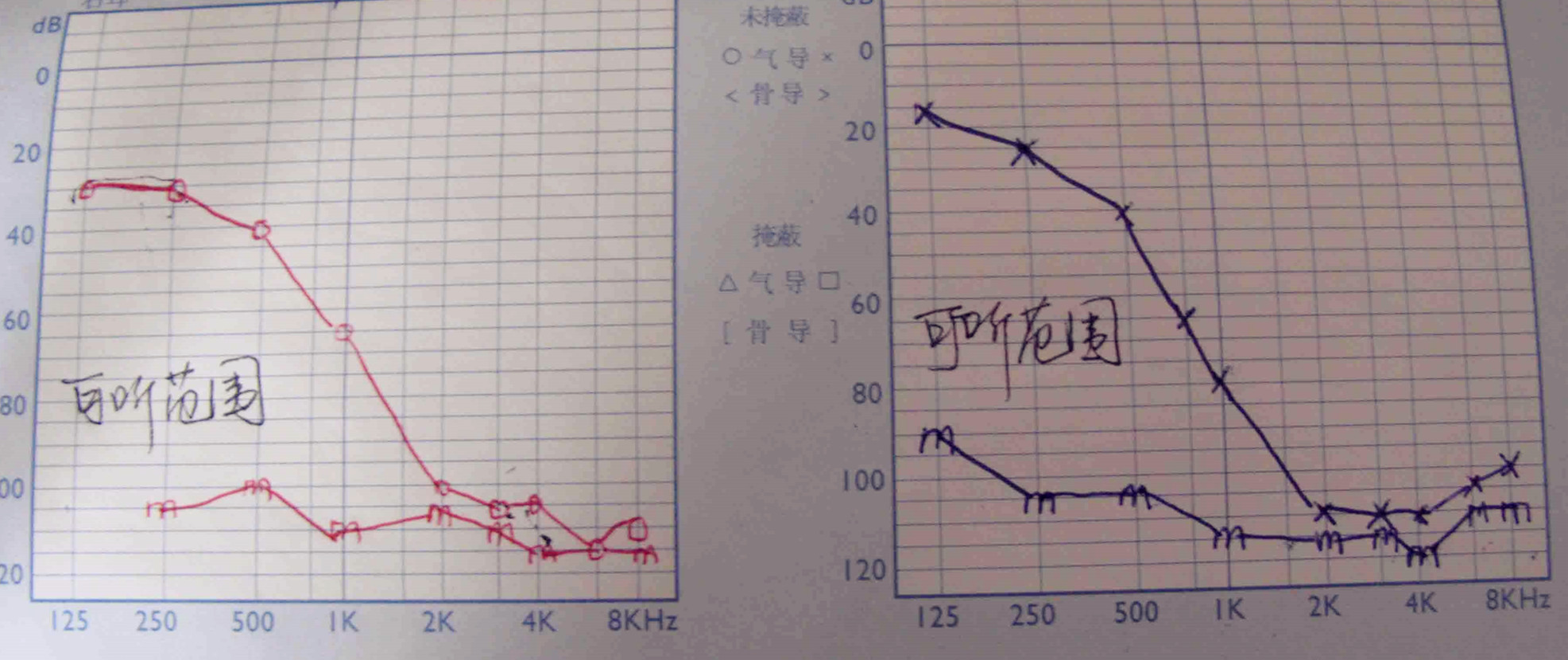 �ൺ������