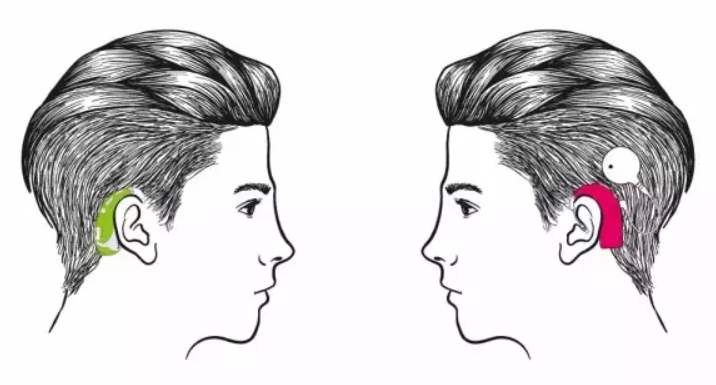 �ൺ������